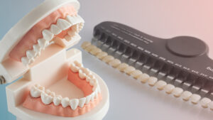 The Ultimate Guide to Full Mouth Dental Implants in Turkey: Cost, Packages, and Top Questions Answered