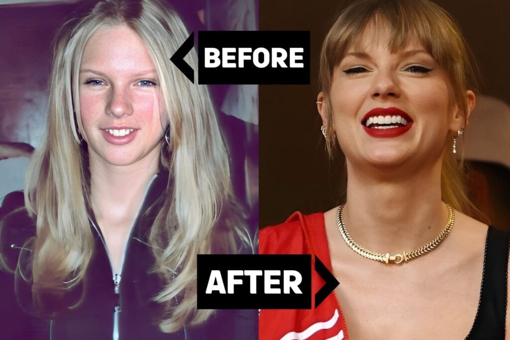 Taylor Swift Teeth