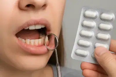 Do You Need Antibiotics for Gum Infection?