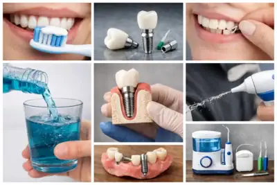 How to Clean Dental Implants
