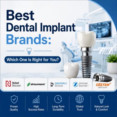 Best Dental Implant Brands