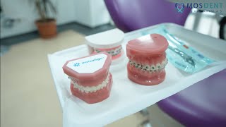 Invisalign Treatment | Dr. Ahmet Murat Artuç | MosDent Dental Hospital